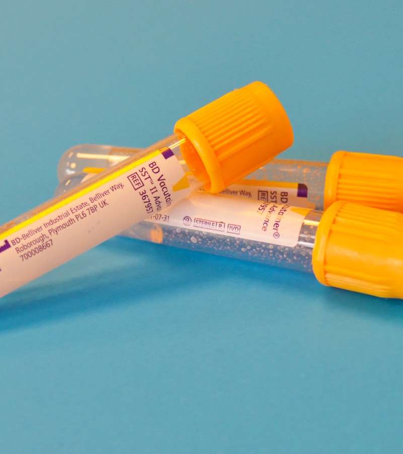 O hemograma completo é um dos exames de laboratório mais solicitados na prática clínica. Através de uma simples colheita de sangue, este exame fornece uma …