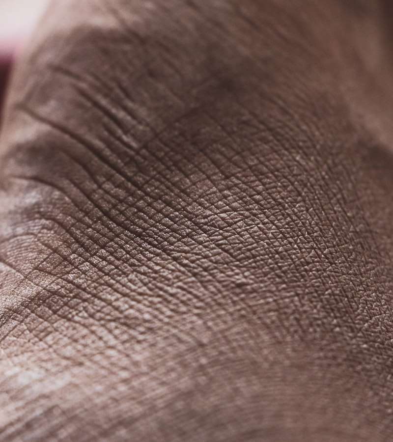 O inchaço nas pernas e tornozelos, conhecido clinicamente como edema de membros inferiores, é uma condição comum que afeta pessoas de todas as idades. Cara…