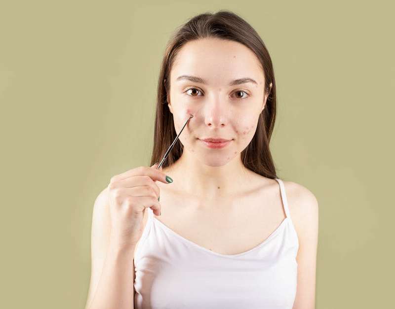 Descobre se as cápsulas Nonacne ajudam a combater a acne adulta. Analisamos os seus ingredientes, desde o zinco ao cardo-mariano, e mostramos a evidência científica.