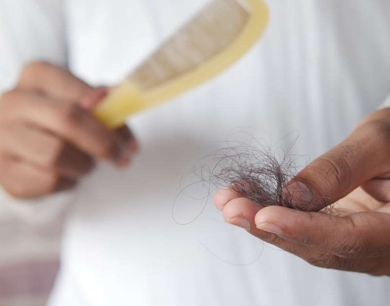 A perda de cabelo é um fenómeno natural que afeta homens e mulheres, sendo que é comum perder entre 50 a 100 fios de cabelo por dia como parte do ciclo nor…